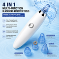 Electric Blackhead Remover Vacuum – Derma Suction Pore Cleaner for Face & Nose Cleaning